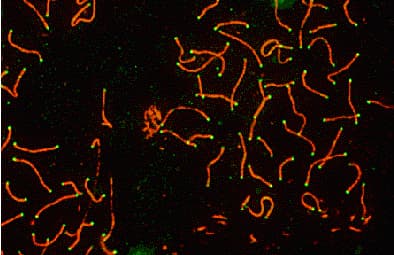 SYCP3 / SCP3 Antibody (C-Terminus)