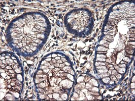 TUBAL3 Antibody (clone OTI4D8)