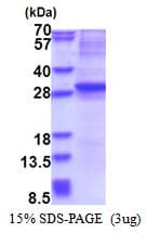 Human NEUROG3 / NGN3 / Neurogenin 3 Protein (Recombinant His)