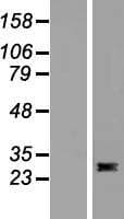 Human FLT3LG / Flt3 Ligand Protein (Over-Expression Lysate Myc-DDK (Flag))