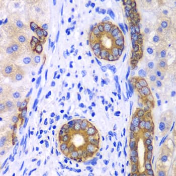 IHC-plus™ KRT19 / CK19 / Cytokeratin 19 Antibody