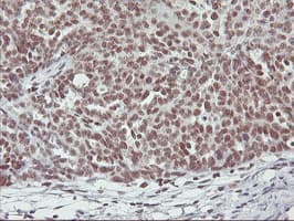 Monoclonal Mouse anti-Human RNF113B Antibody (clone OTI7A1, IHC, IF, WB)