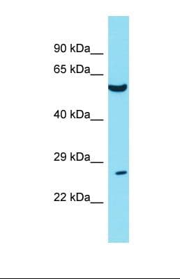TWIST1 / TWIST Antibody (N-Terminus)