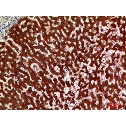 HSD11B1 / HSD11B Antibody (1-50 aa, N-terminal)