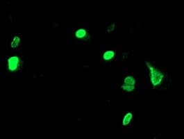 UNG / Uracil DNA Glycosylase Antibody (clone OTI2B5)
