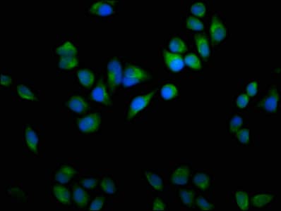 USP9X / FAM Antibody