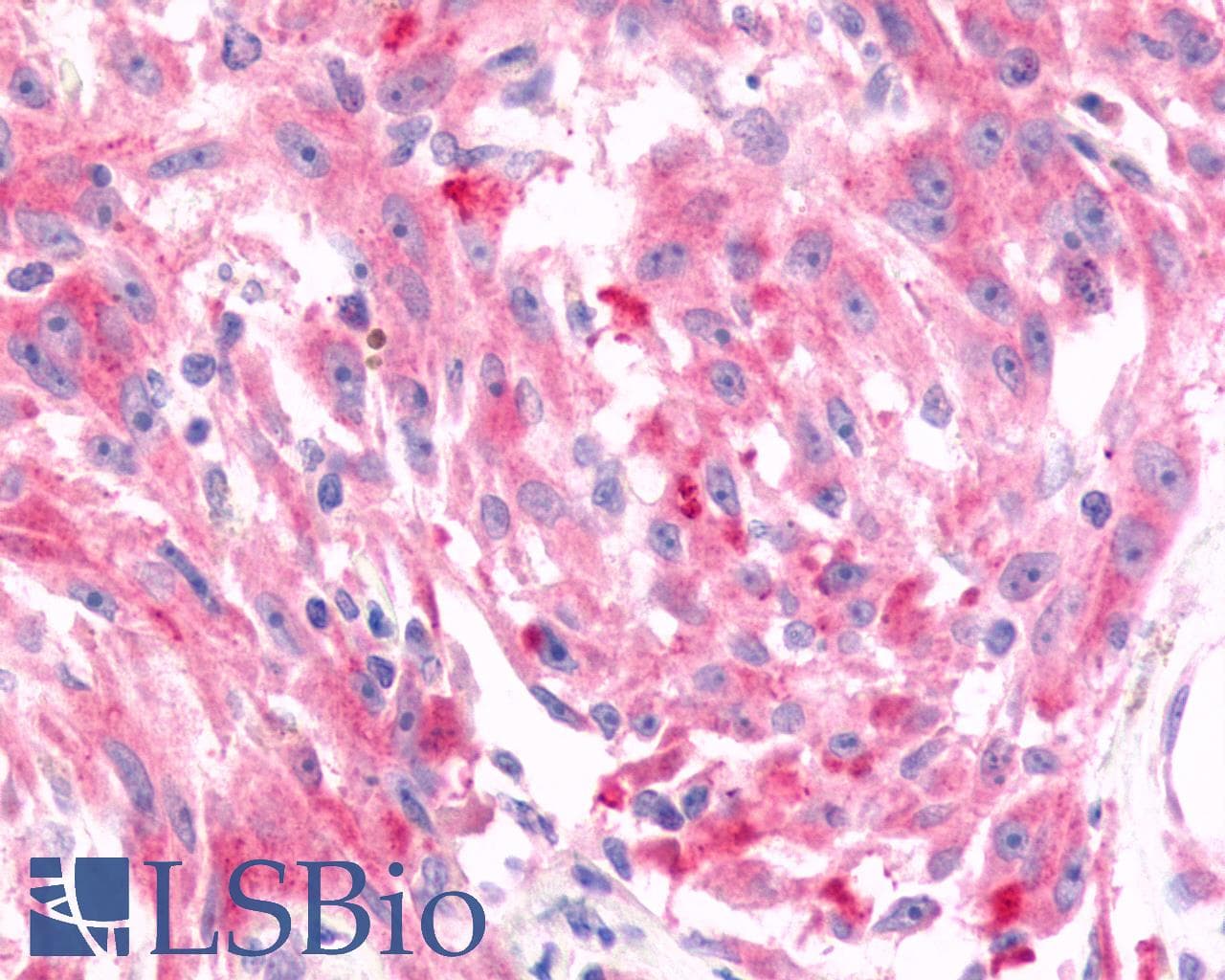 PathPlus™ Polyclonal Rabbit anti-Human FZD6 / Frizzled 6 Antibody (N-Terminus, IHC)
