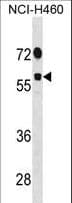 DDX19B Antibody (aa7-36)