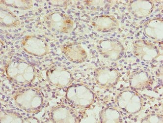 DNAJB8 Antibody