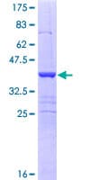 Human SEMA6B / Semaphorin 6B Protein (Recombinant GST, N-terminus)