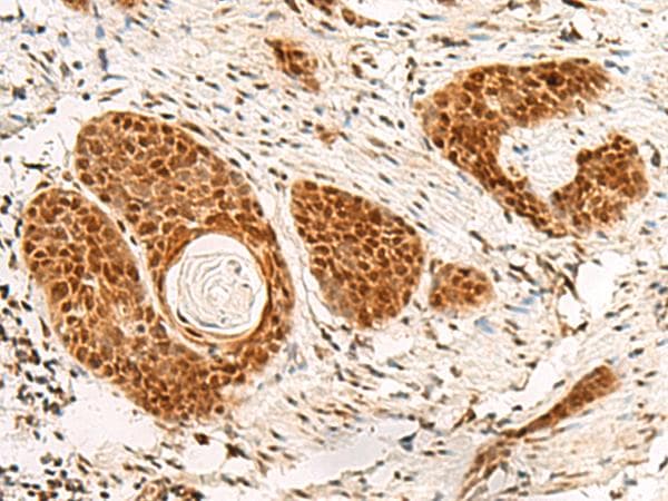 POM121 Antibody