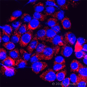 Polyclonal Rabbit anti-Human TRPM7 Antibody (4th Cytoplasmic Domain, IF, WB)