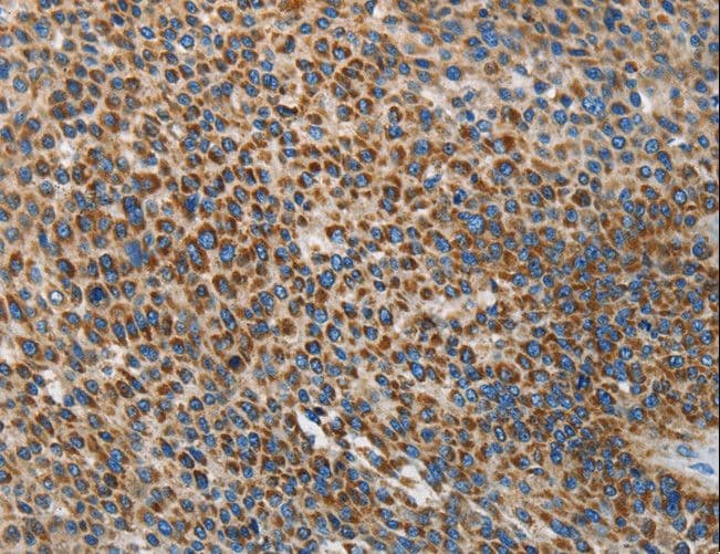 Polyclonal Rabbit anti-Human RENT1 / UPF1 Antibody (IHC, WB)