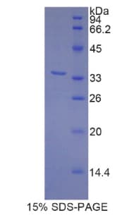 Rat MYH3 Protein (Recombinant His-T7)