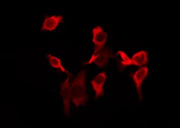 CD247 / CD3 Zeta Antibody