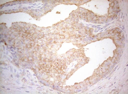 TWF1 / PTK9 Antibody (aa140-384, clone OTI5C12)