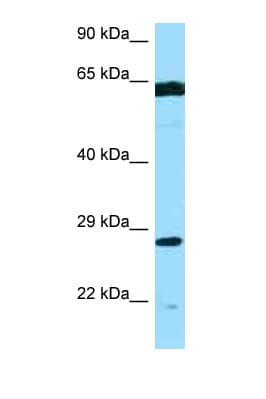 PMM2 Antibody (aa120-169)