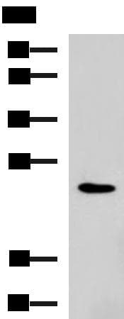Polyclonal Rabbit anti-Human RAB38 Antibody (IHC, WB)
