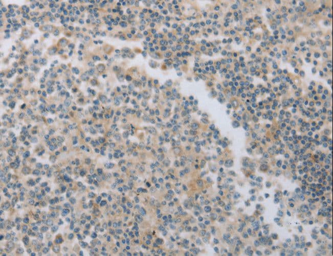 Polyclonal Rabbit anti-Human MAGED1 / NRAGE Antibody (IHC, WB)