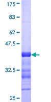 Human YAP / YAP1 Protein (Recombinant GST, N-terminus)