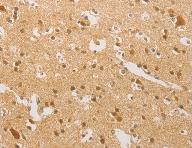 Polyclonal Rabbit anti-Human HIPK4 Antibody (IHC)