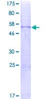 Human CIDEA / CIDE-A Protein (Recombinant GST)