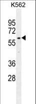 DCAF8L2 Antibody (aa112-140)