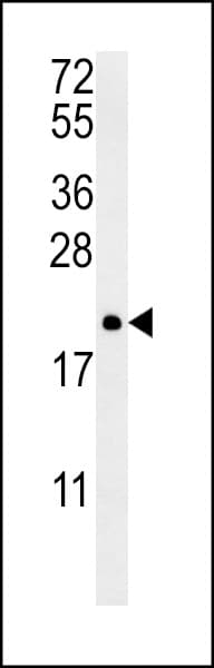 PTP4A2 / PRL-2 Antibody (aa32-59)