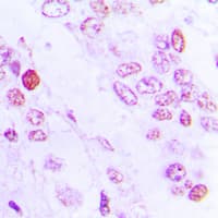 C/EBP Beta / CEBPB Antibody (Internal)