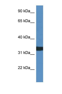 ACER1 / ASAH3 Antibody (aa141-190)