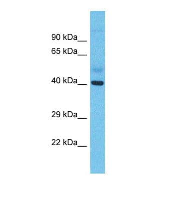 Polyclonal Rabbit anti-Human ME1 / Malate Dehydrogenase Antibody (aa246-295, WB)