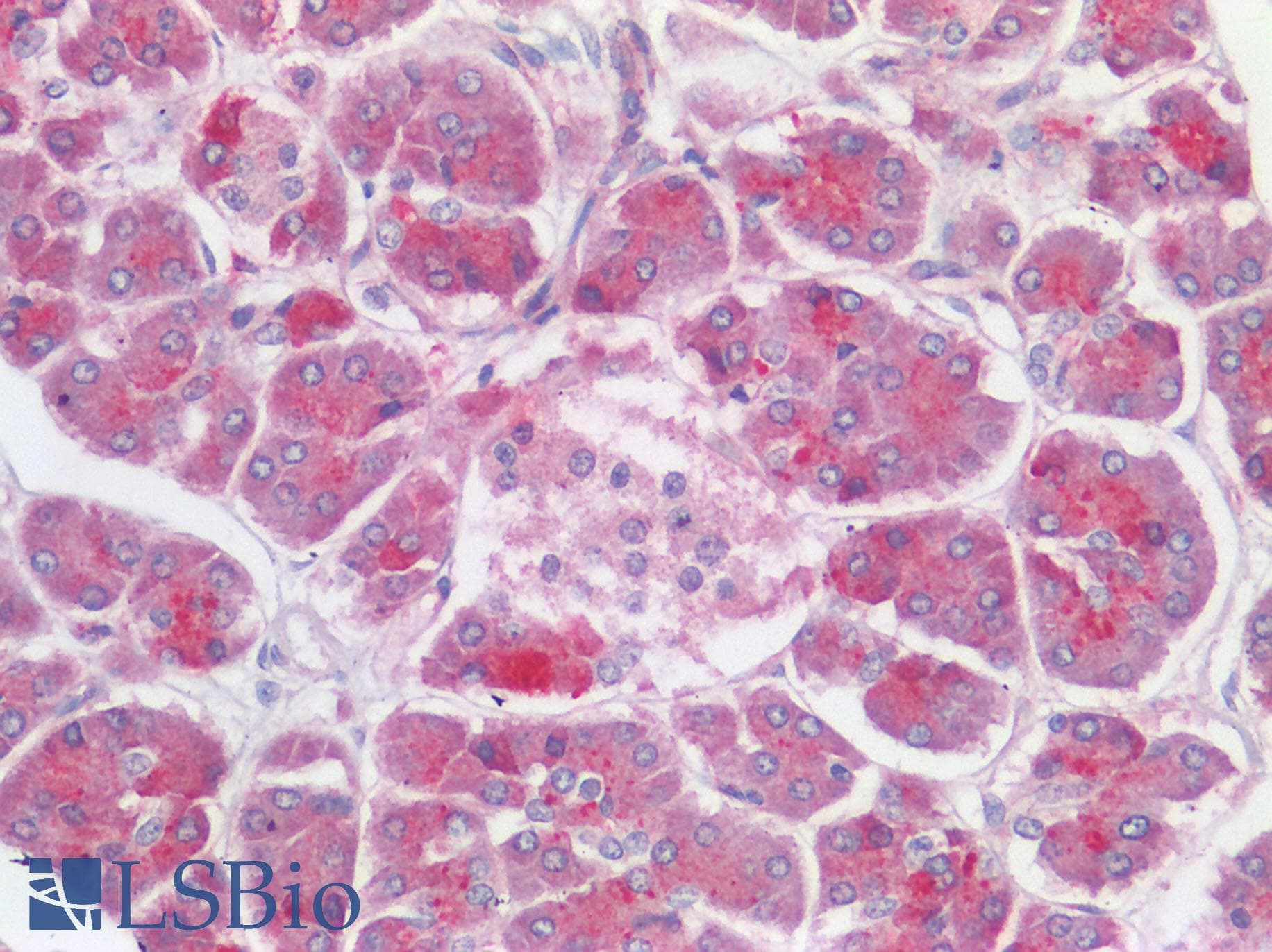 IHC-plus™ TMPRSS2 / Epitheliasin Antibody