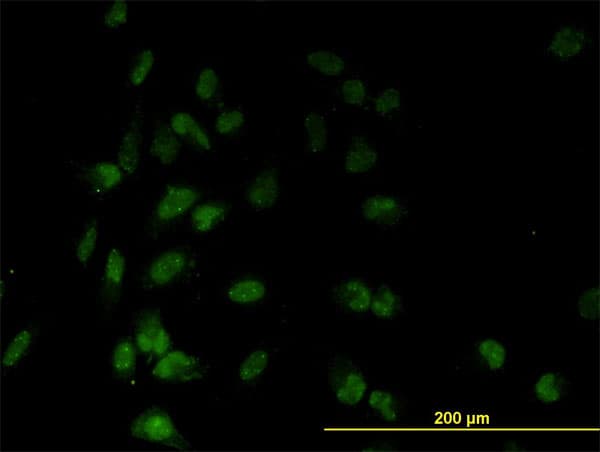 Monoclonal Mouse anti-Human TAF7 Antibody (clone 2C5, IHC, IF, WB)
