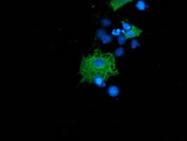 SH2B3 / LNK Antibody (clone OTI2D8)