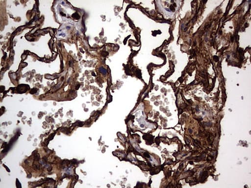 Monoclonal Mouse anti-Human CEACAM5 / CD66e Antibody (clone OTI3D8, aa35-680, IHC, WB)