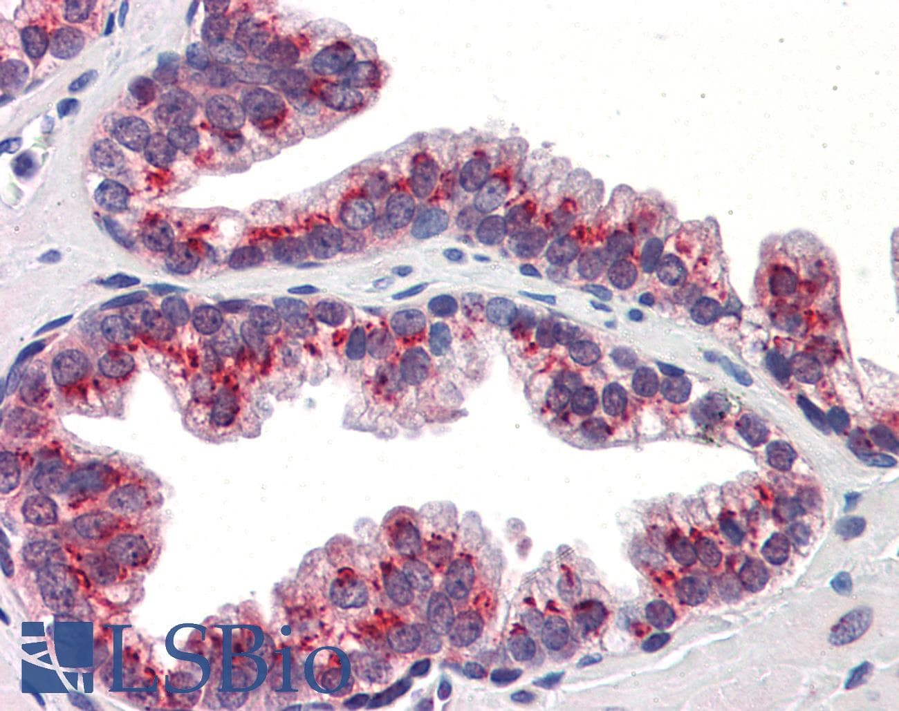 Polyclonal Rabbit anti-Human KLF4 Antibody (aa401-450, IHC, WB)