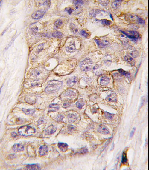 PIK3C2B Antibody (aa120-150)