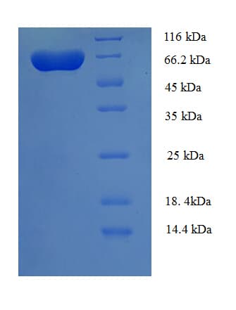 Human UGP2 Protein (Recombinant His-SUMO)