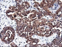 ALS2CR1 / NIF3L1 Antibody (clone OTI4B5)