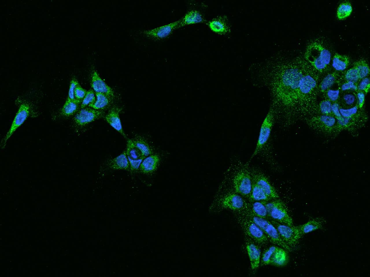 Polyclonal Rabbit anti-Human PECR Antibody (IHC, IF, WB)