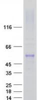 Human FSCN1 / Fascin Protein (Recombinant Myc-DDK (Flag))