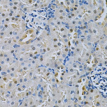 SPHK / SPHK1 Antibody
