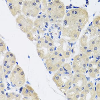 Polyclonal Rabbit anti-Human ALAD Antibody (IHC, WB)
