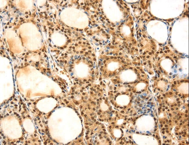 SAMD3 Antibody