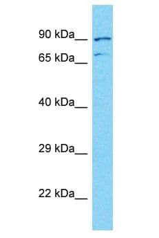 NUTM2A Antibody (aa828-877)