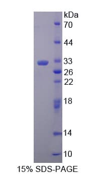 Human ETFB Protein (Recombinant His-T7)