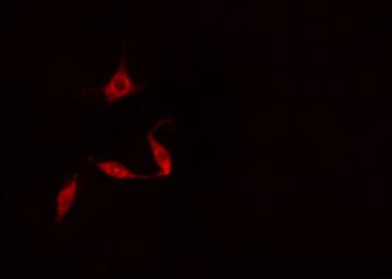 DAPK3 / ZIP Kinase Antibody