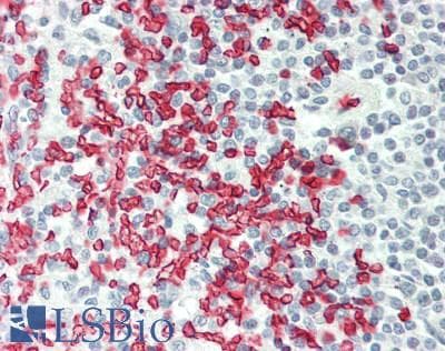 ERMAP / SC Antibody (aa324-373)