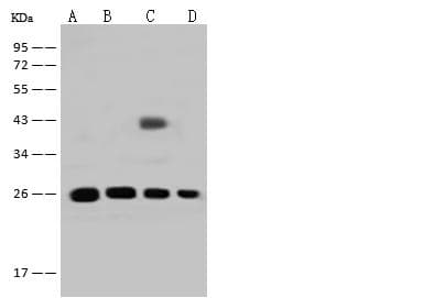 Polyclonal Rabbit anti-Human GSTT2B Antibody (WB)
