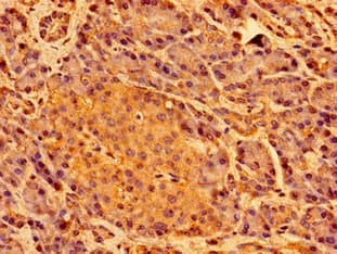 Polyclonal Rabbit anti-Human SHE Antibody (IHC, WB)